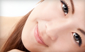 Up to 76% Off Peels or Microdermabrasion